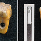 8,500-year-old human teeth with holes drilled into them.